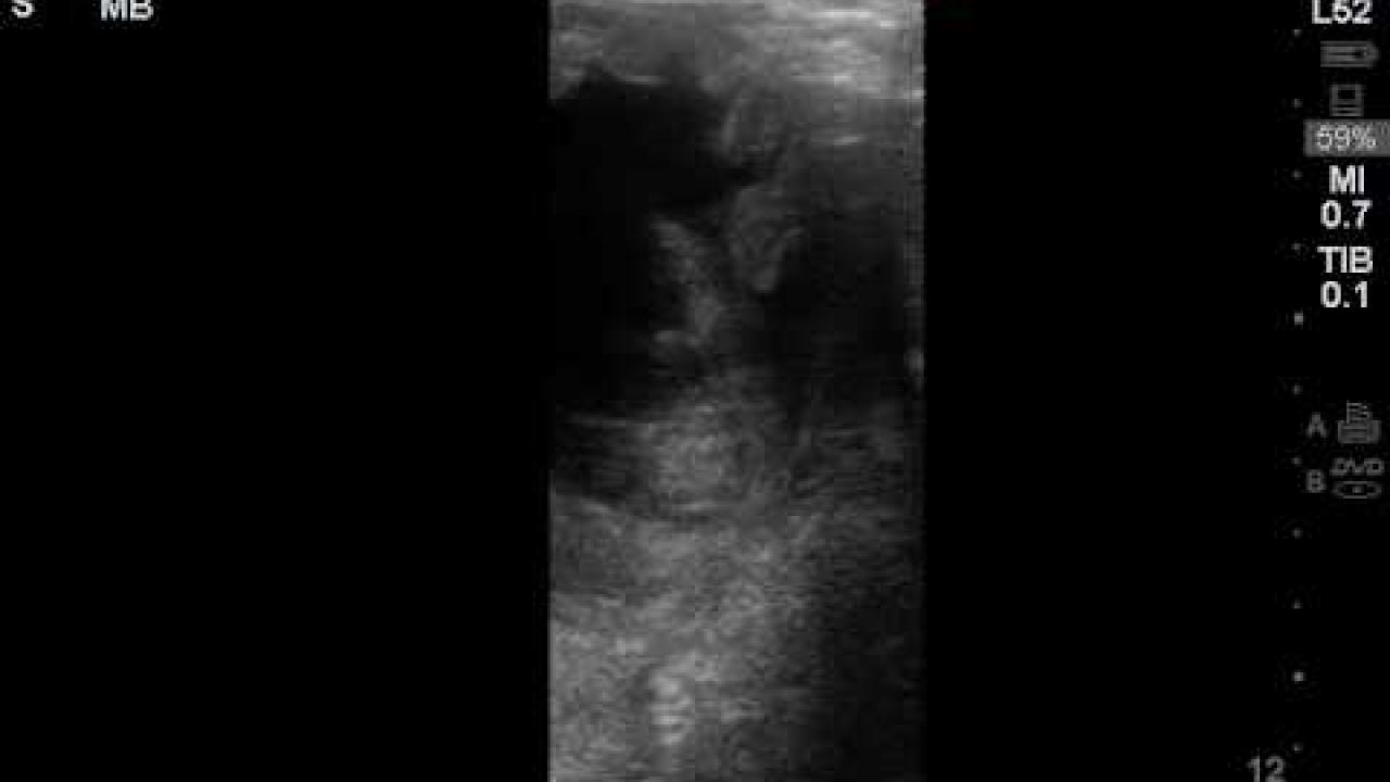 Equine Assisted Reproductive Technology