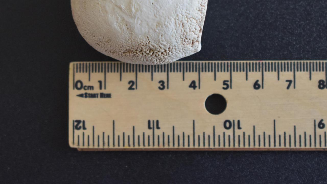 Picture of a sialolith that was surgically removed from a horse