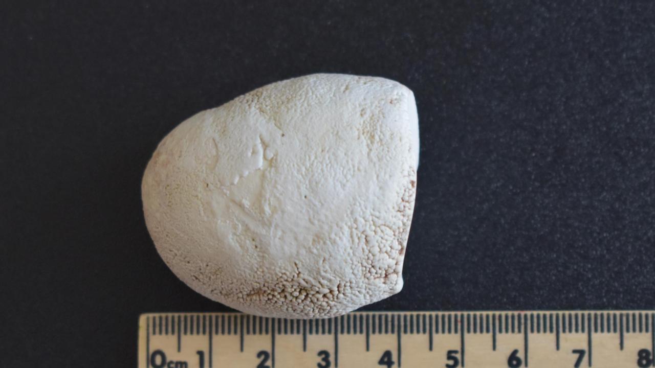 Picture of a sialolith that was surgically removed from a horse