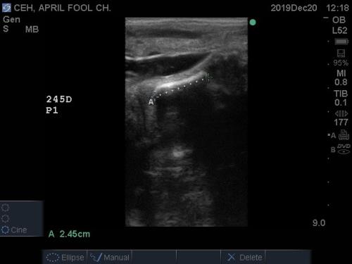 ultrasound image of P1 in a horse fetus