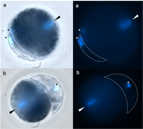 zygotes stained with DAPI after ICSI