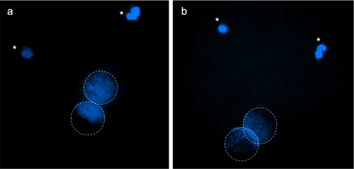 zygotes stained with Hoechst after ICSI