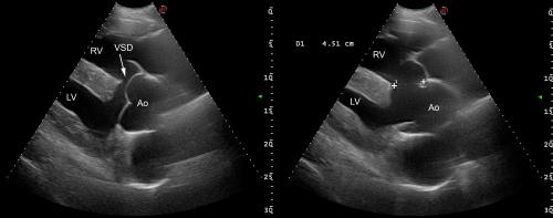 ultrasound images of Cash's heart